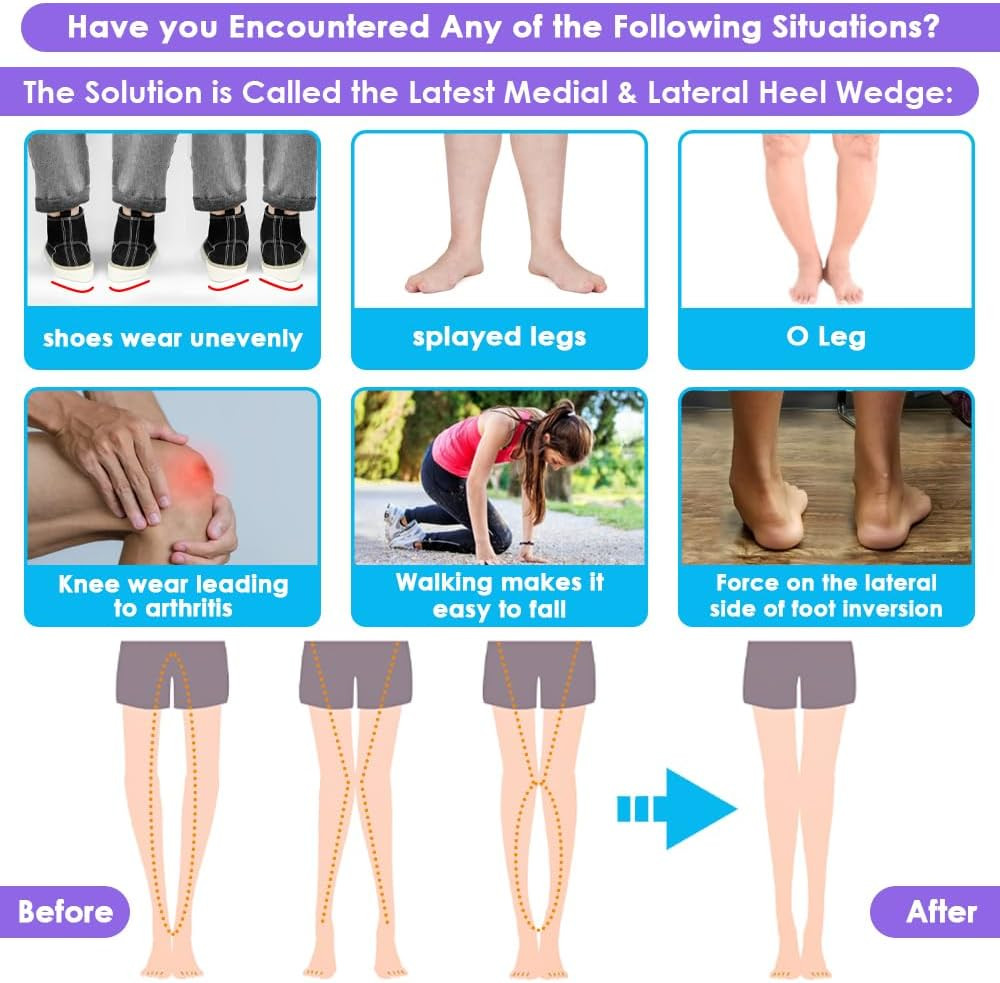 3 Layers Adjustable Supination Overpronation Insoles, Anti-Slip Medial Lateral H